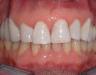 estetica dentale