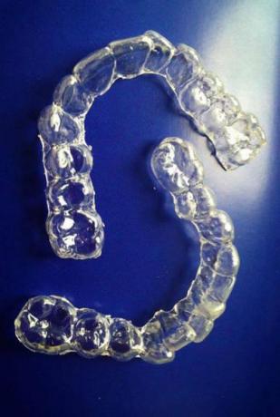 mascherina per sbiancamento dentale